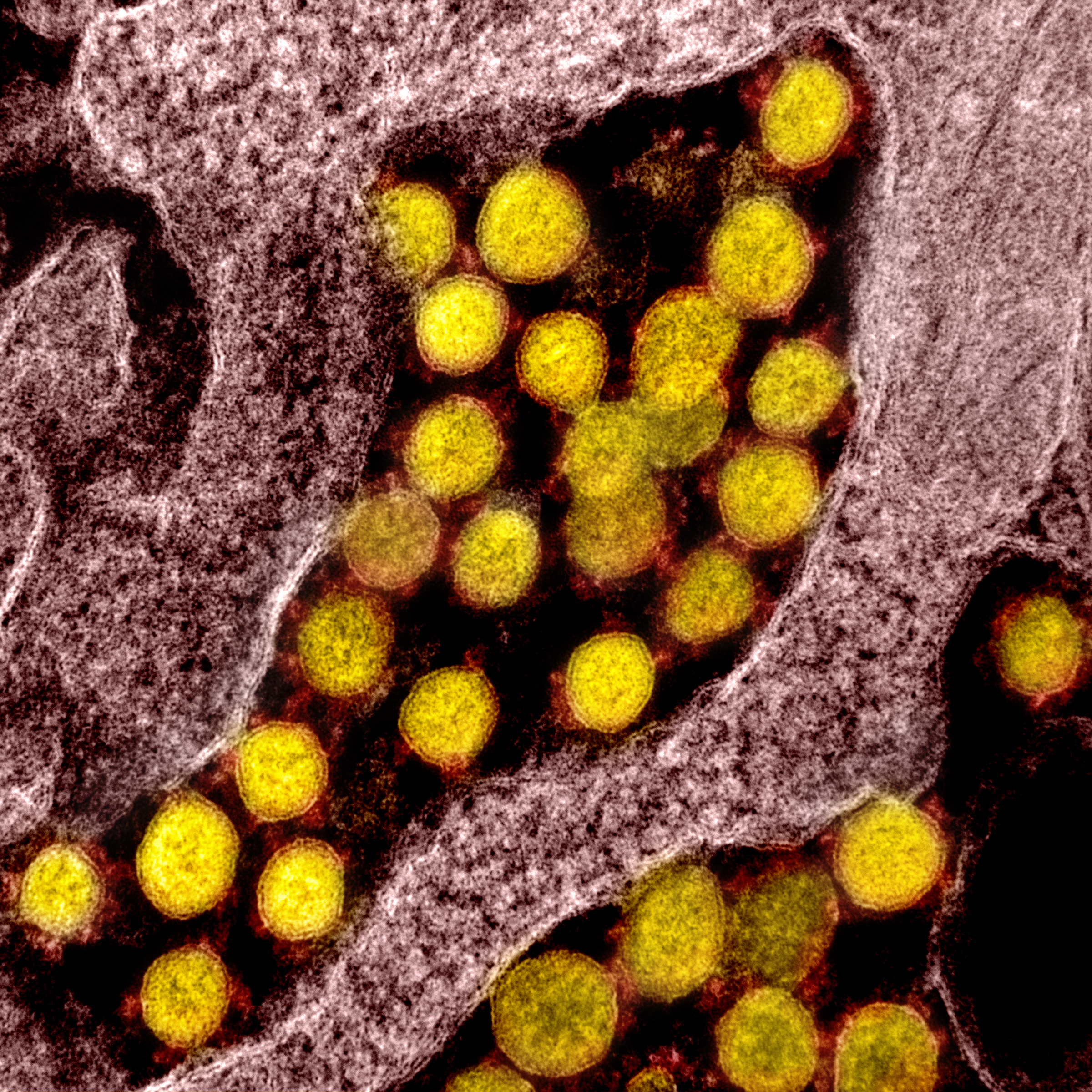 A collection of coronavirus particles, yellow circles with red spikes emerging from them.