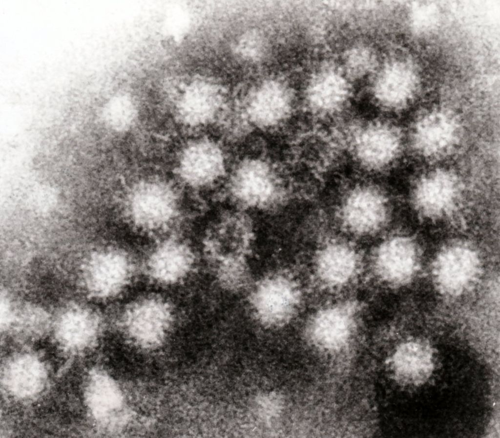 norovirus