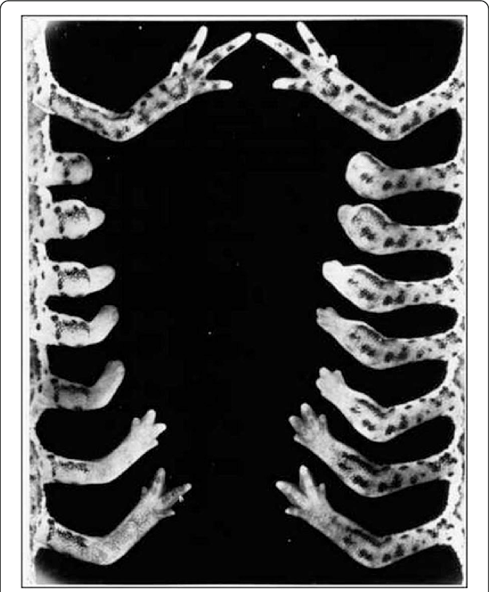 Limb regeneration in salamanders