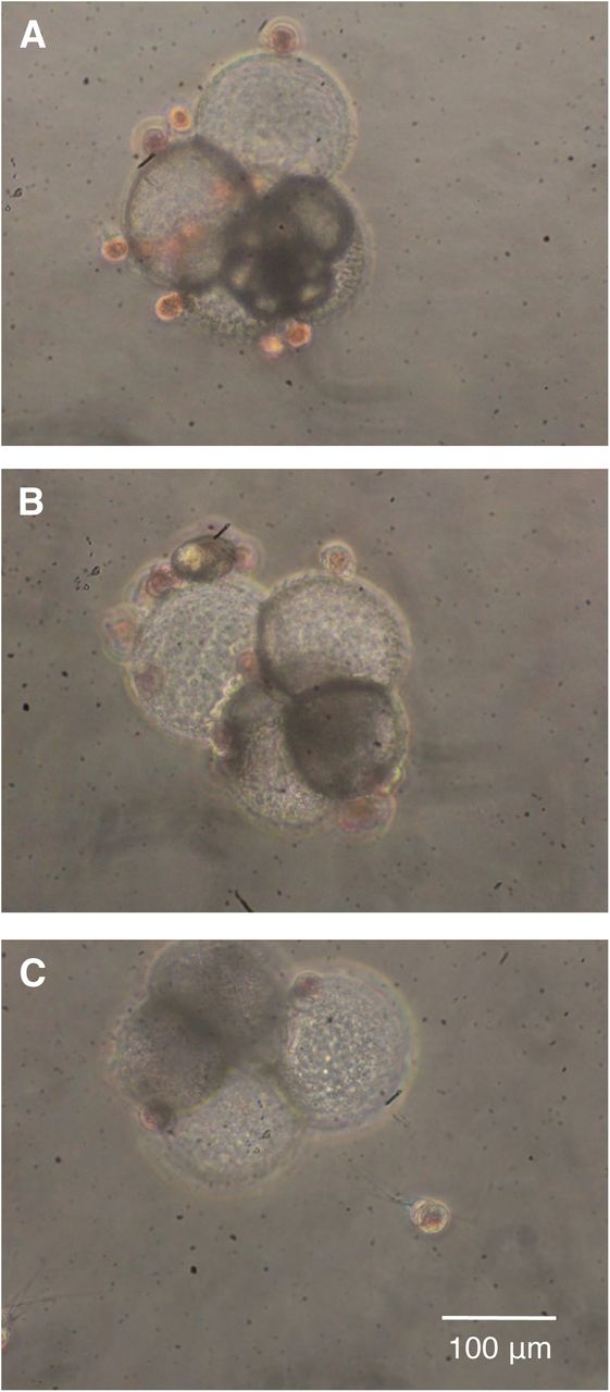 Foraminifera and children in first three days children were observed