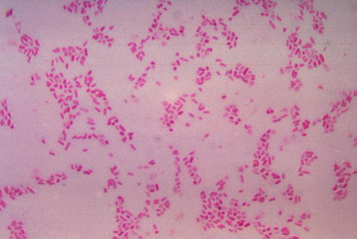 Bacteroides fragilis, a common bacteria that occurs in the gut, oblong spheres stained pink.