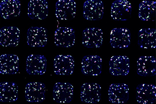 Kidney organoids derived from human stem cells growing in a testing chamber