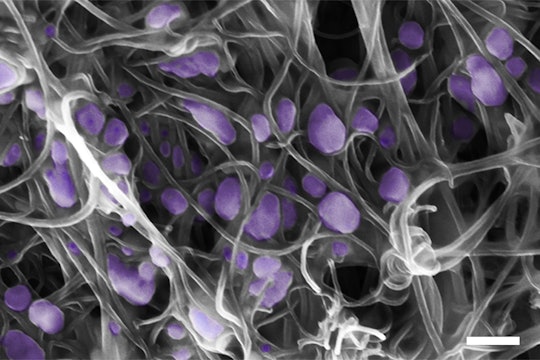 Viruses caught on nanotube "forest" Viruses caught on nanotube "forest"