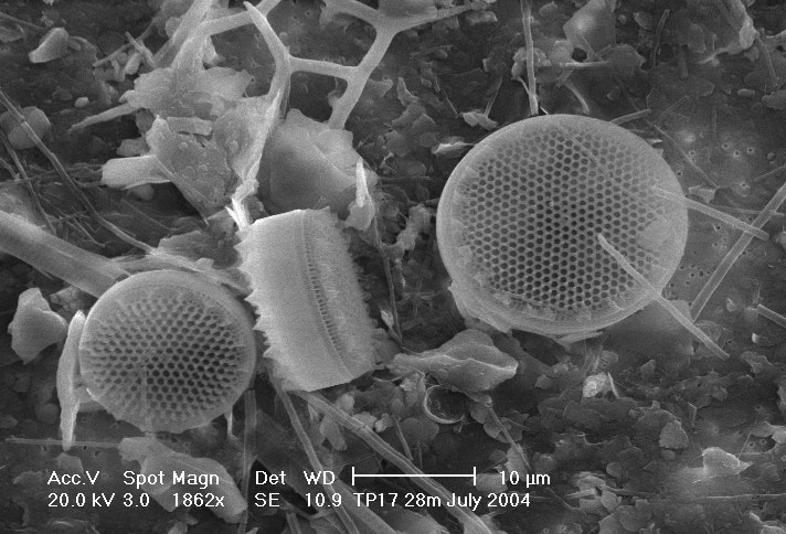Suspended particulate matter (SPM) in Thermaikos Gulf, Greece, 2004. Scanning electron microscope (SEM) backscattered images of SPM collected on a membrane filter (pore size 0.4 μm). Diatoms Chaetoceros spp. can be identified.