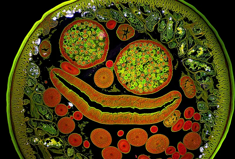 Intestinal roundworm cells eat their own DNA as part of a healthy lifecycle