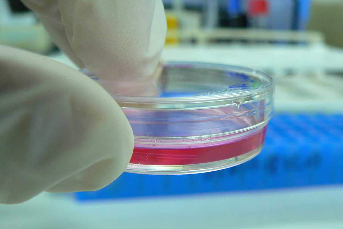A petri dish with cell culture medium.