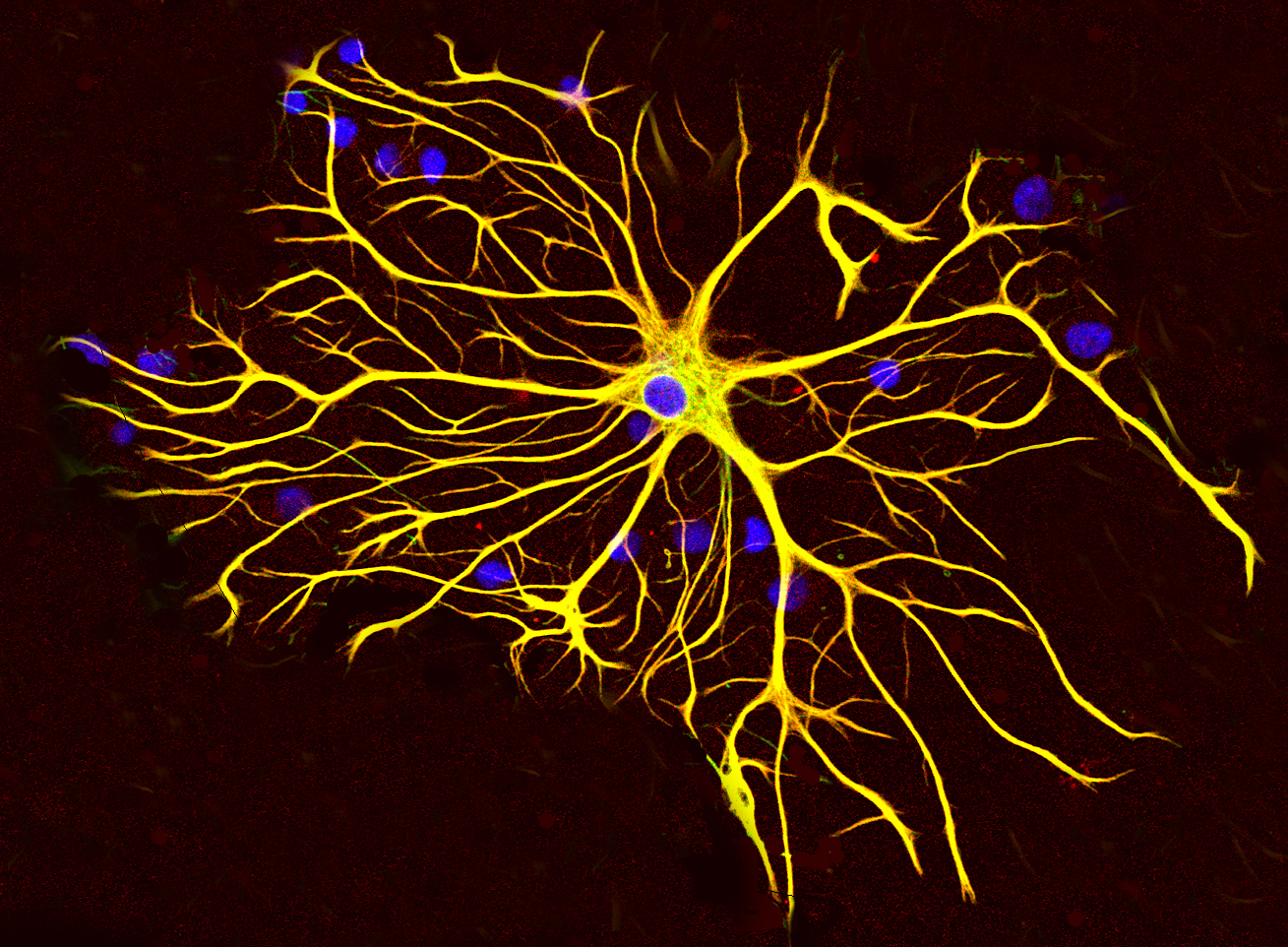 An astrocyte, a type of brain cell.