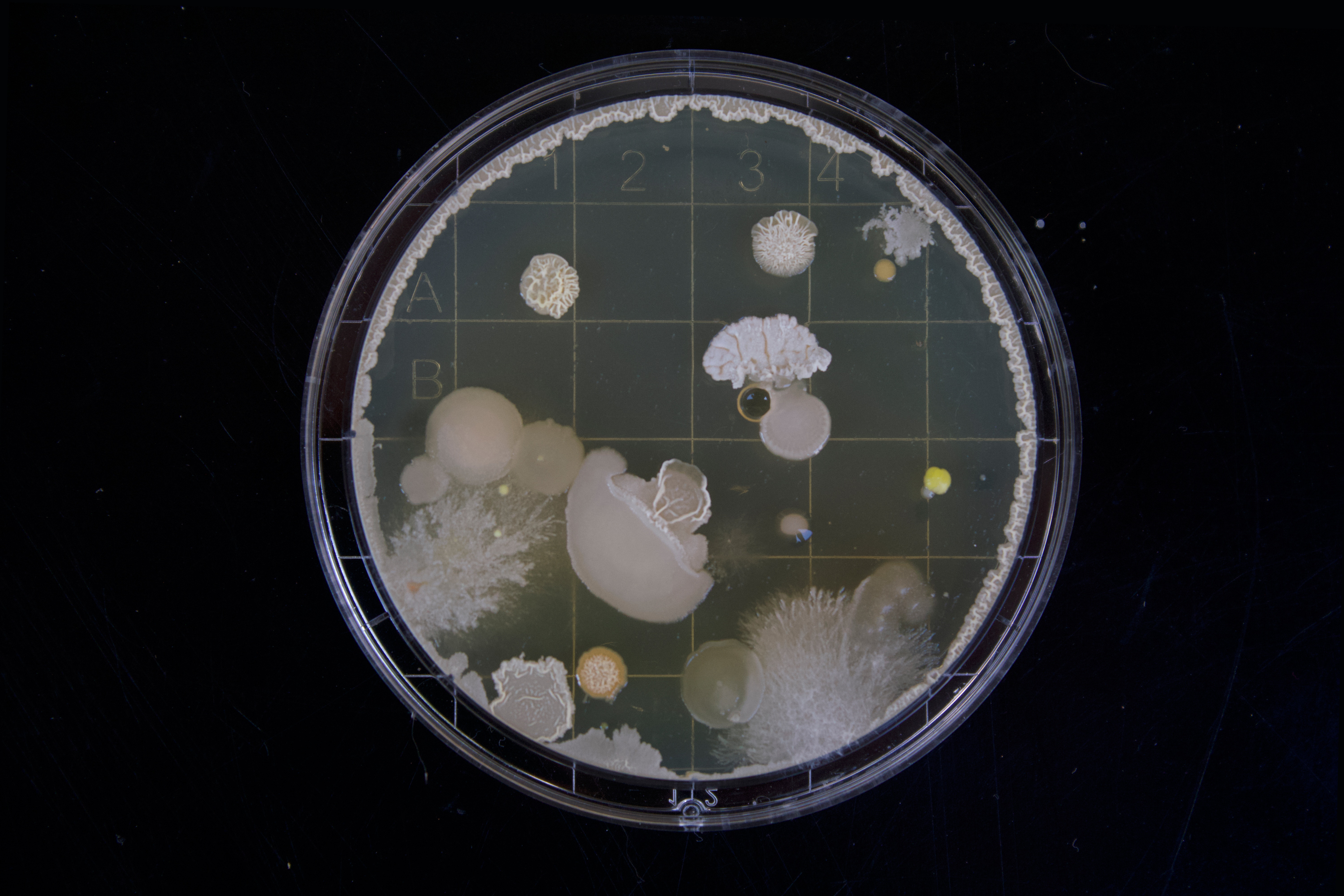 petri dish with growth