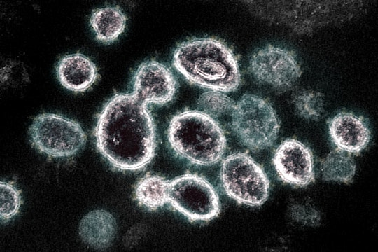 Transmission Electron Microscope image of SARS COV 2 virus