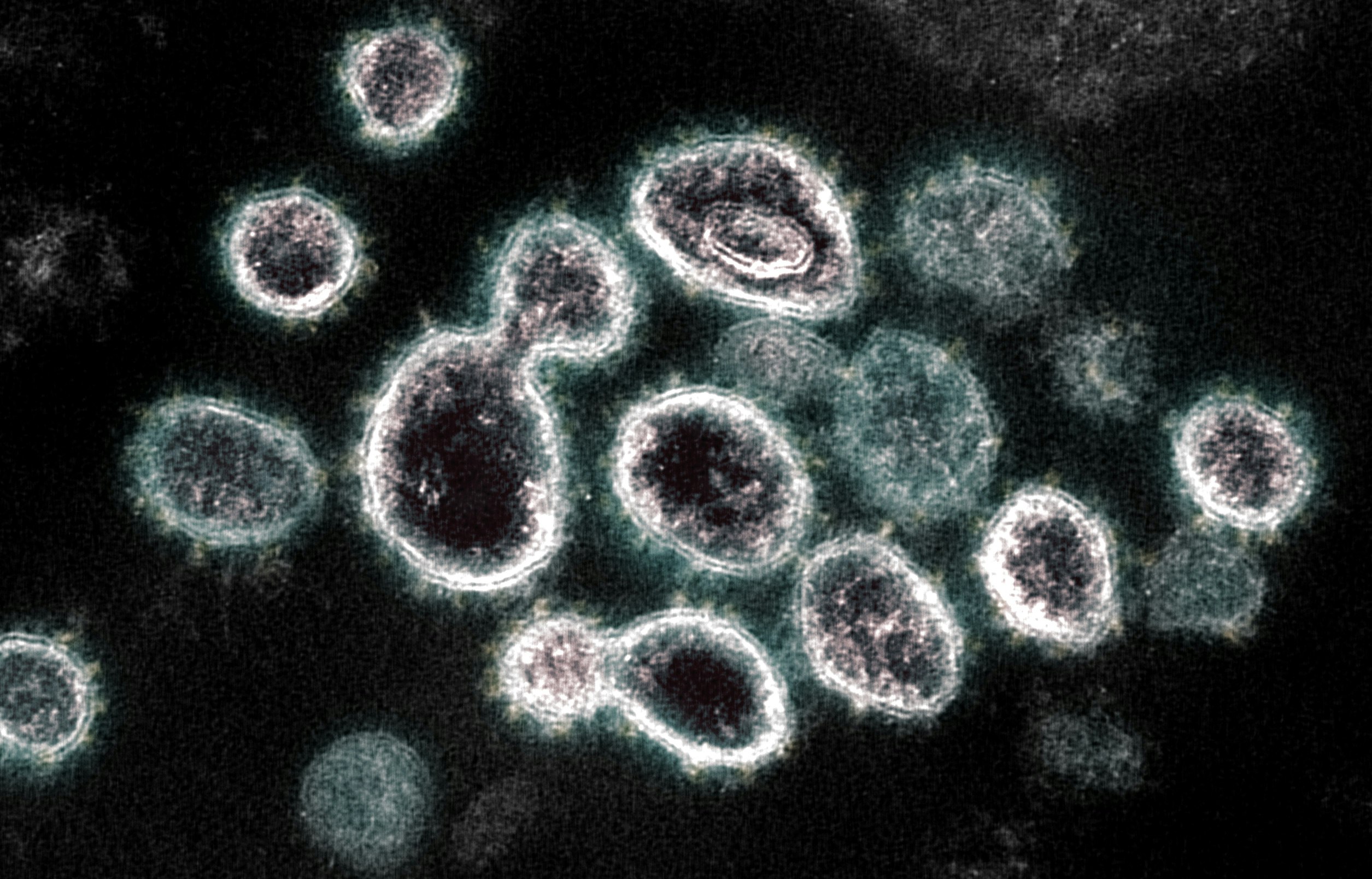 Transmission Electron Microscope image of SARS COV 2 virus