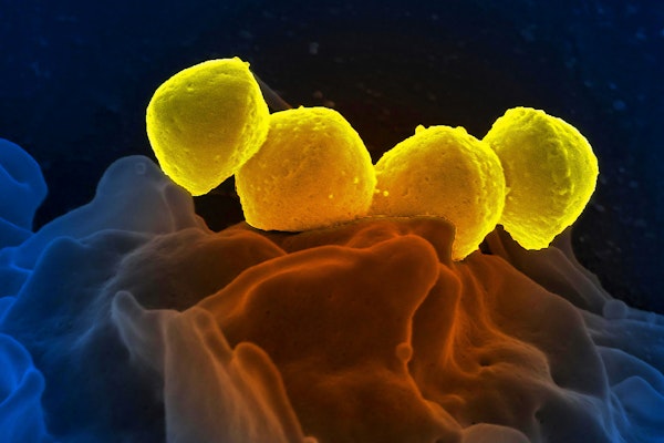 close up of glowing yellow bacteria against a dark blue and brown background