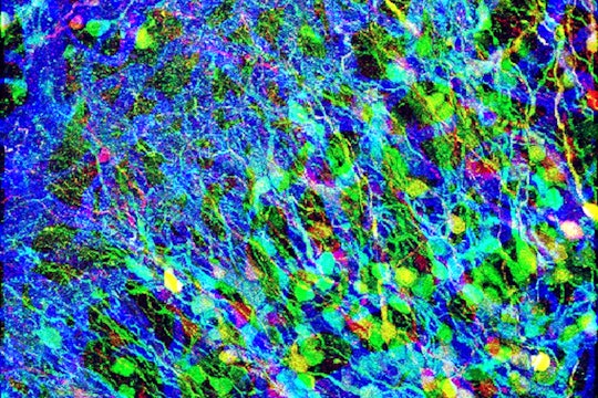 neural progenitor cells color microscope image of neural progenitor cells