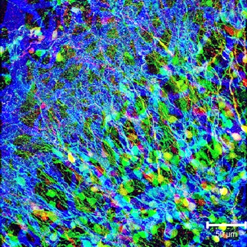 color microscope image of neural progenitor cells