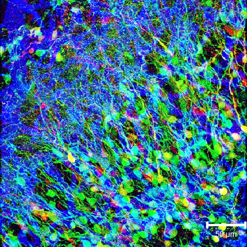 color microscope image of neural progenitor cells