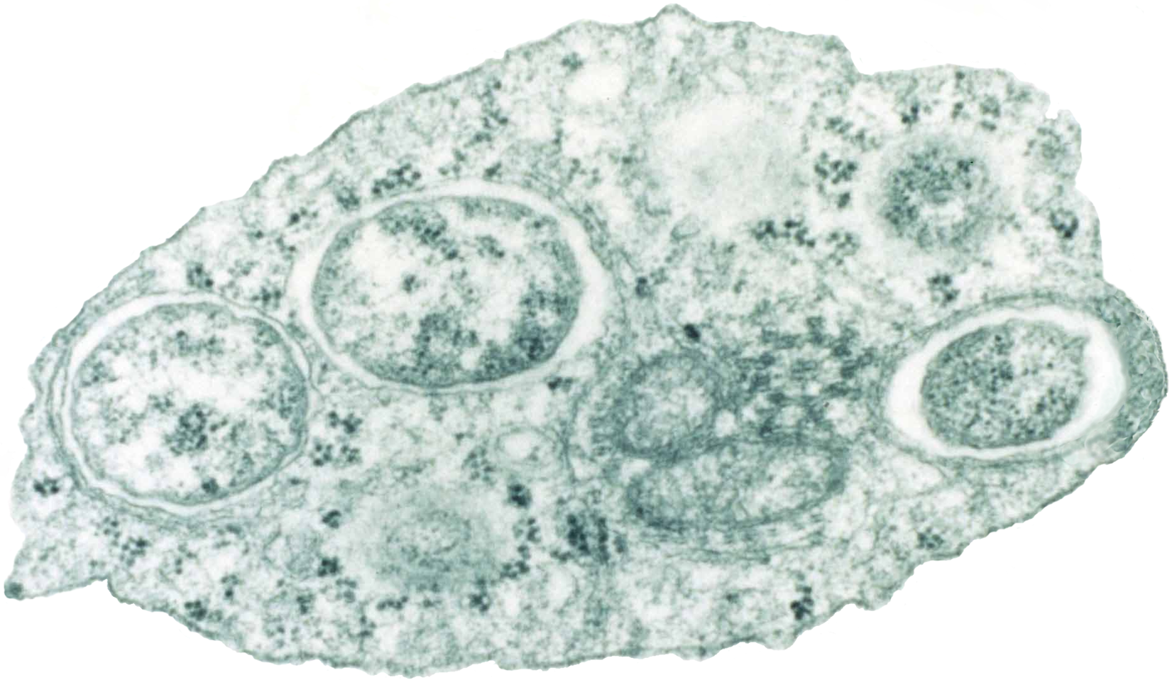 micrograph of the wolbachia bacterium