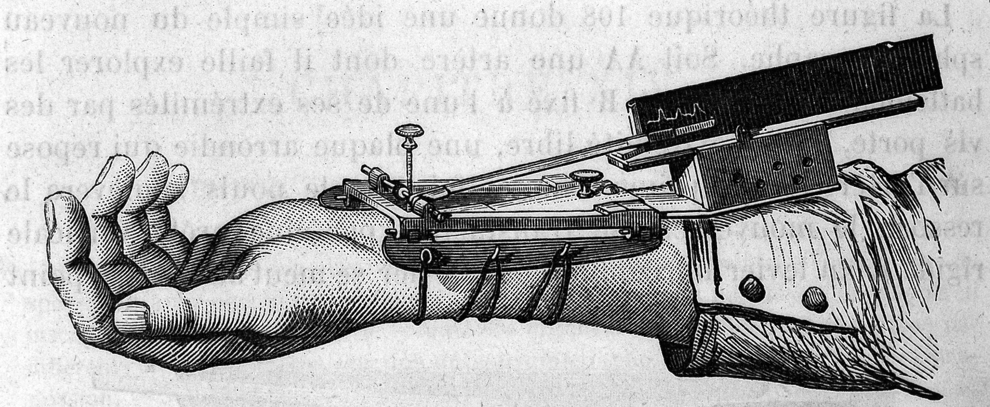 A sphygmograph, a device for measuring a pulse, attached to a person's wrist