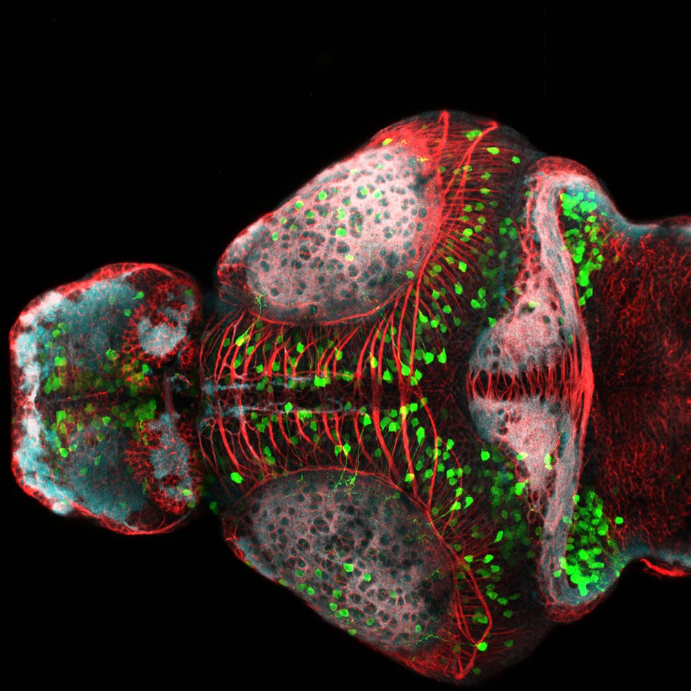 Developing zebrafish brain