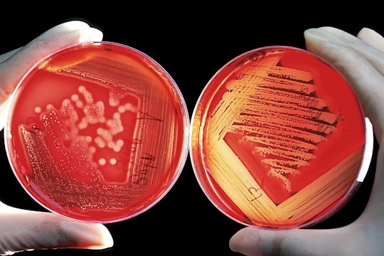 bacterial colonies person holding two petri dishes of bacteria