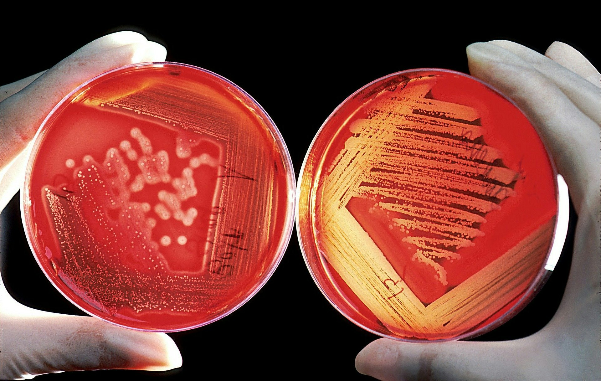 person holding two petri dishes of bacteria