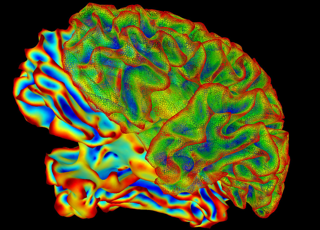 Multi-color whole brain image taken by fMRI