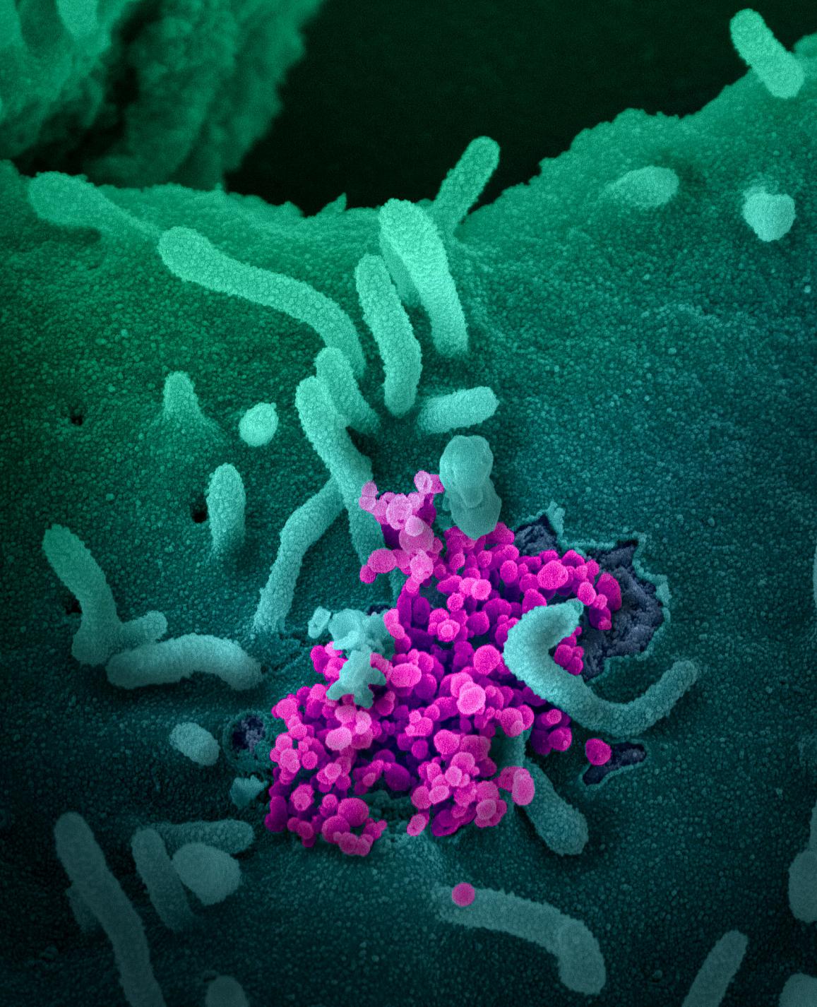 SARS-CoV-2, coronavirus, emerging from a cell cultured in a lab.