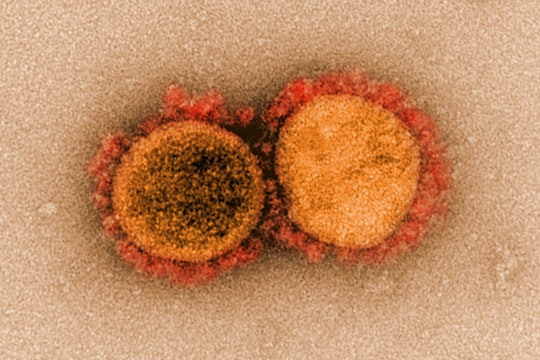 SARS-CoV-2 (coronavirus) virus particles, isolated from a patient.