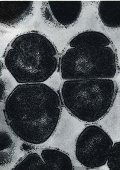 Streptococcus seen under 70,000-fold magnification with an electron micrograph