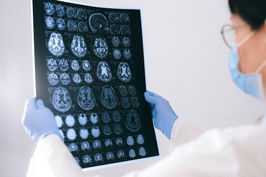 brain person holding up brain images