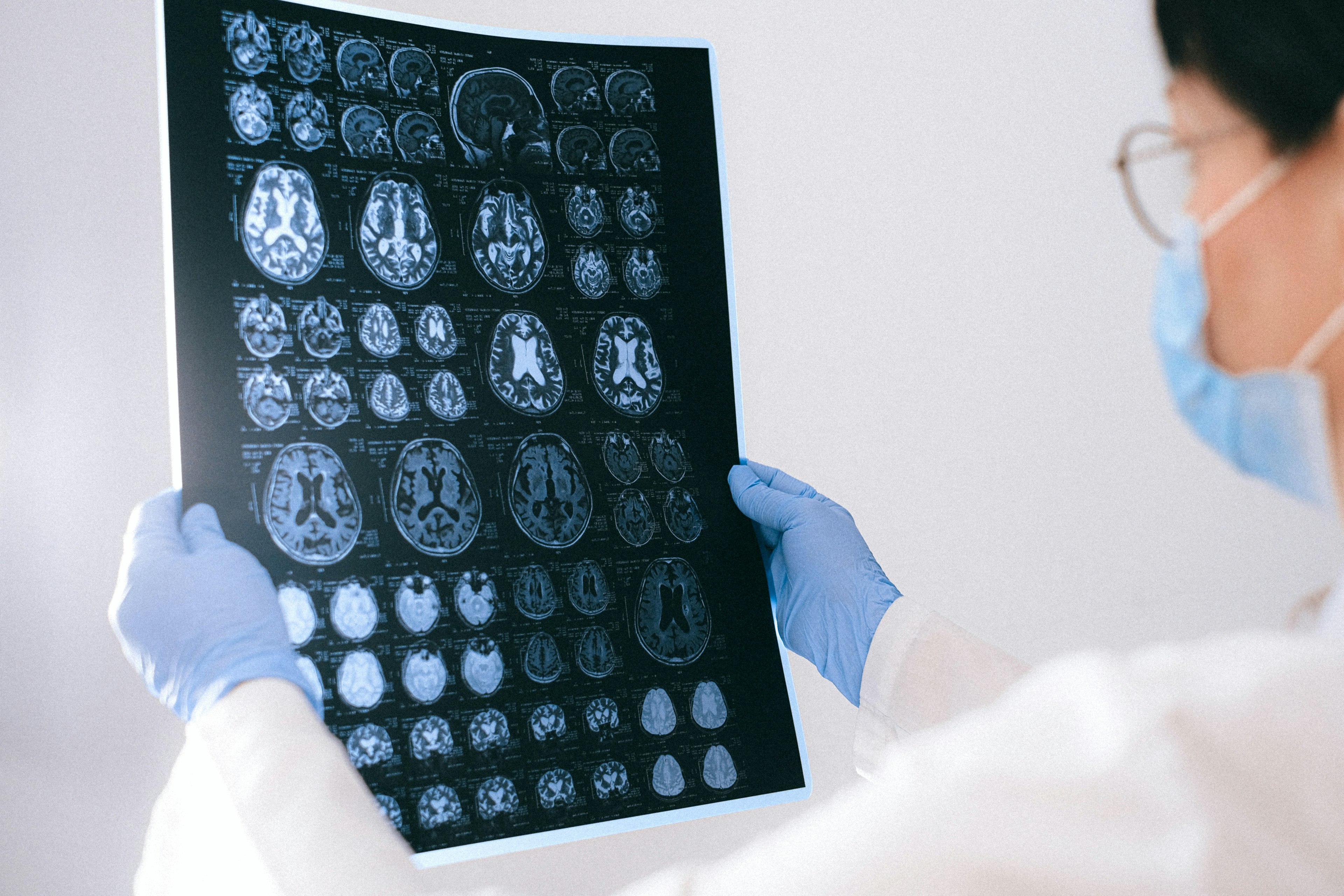 person holding up brain images
