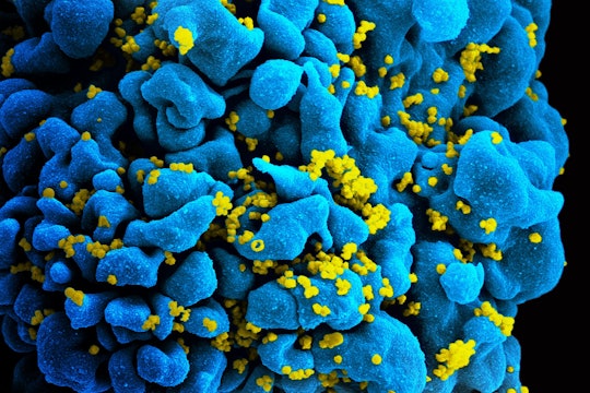 Scanning electromicrograph of an HIV-infected T cell Scanning electromicrograph of an HIV-infected T cell