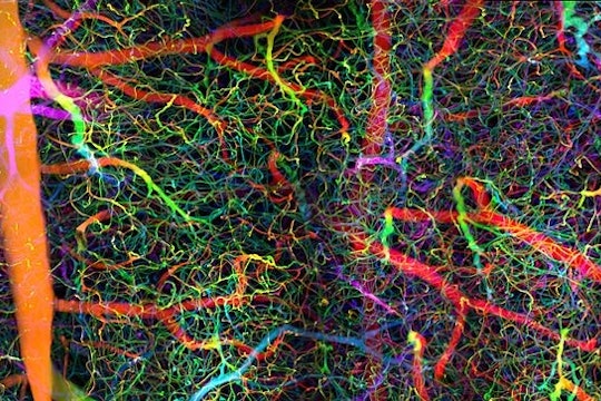 multi-colored depiction of blood vessels