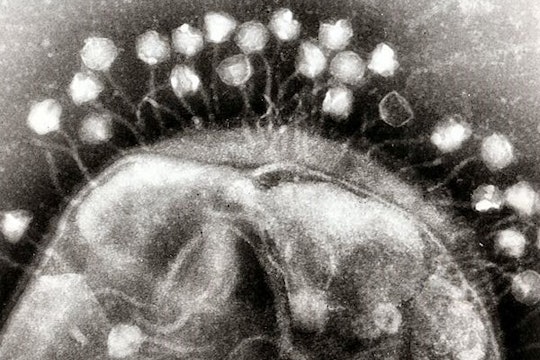 black and white microscope image of a bacteriophage attached to a bacterium
