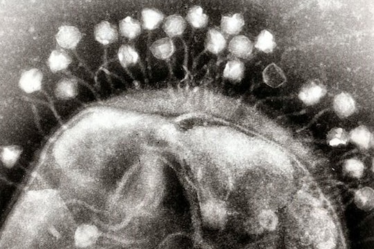 bacteriophage black and white microscope image of a bacteriophage attached to a bacterium