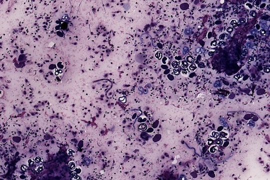 a microscope slide of a nematode parasite