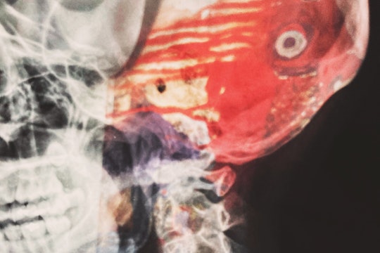 close up of a head xray with added colors