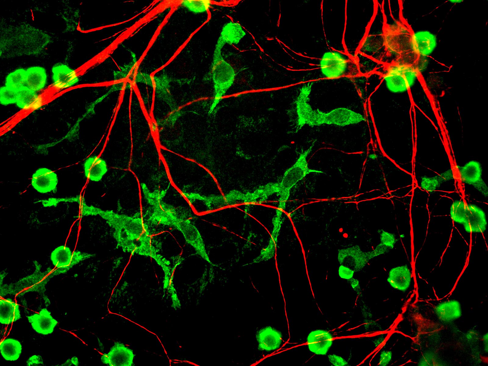 Microglia (green) and neurons (red) showing these two cell types interact closely with each other in the brain