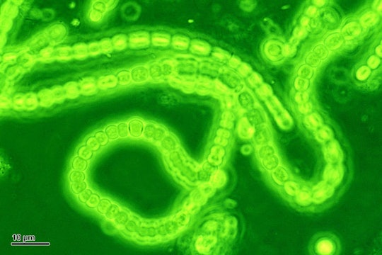 cyanobacteria glowing green against a dark green background