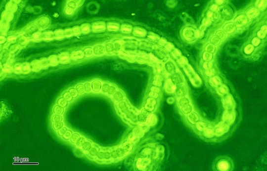 cyanobacteria glowing green against a dark green background