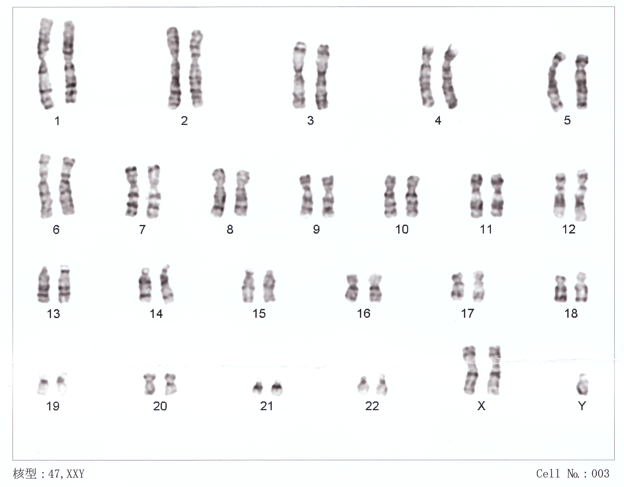 2084px x 1628px - Sex isn't binary, and we should stop acting like it is