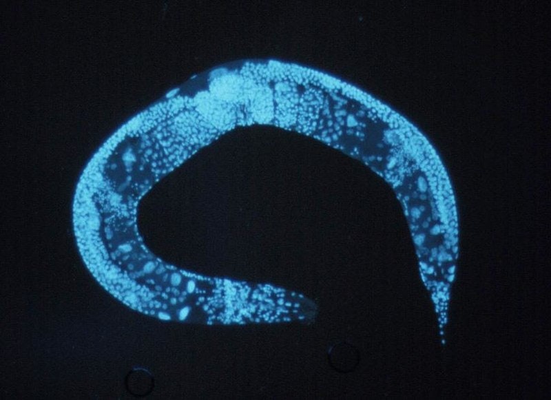 a stained blue roundworm against a black background