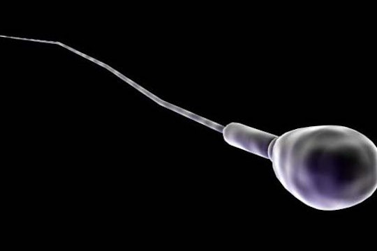 A spermotozoa