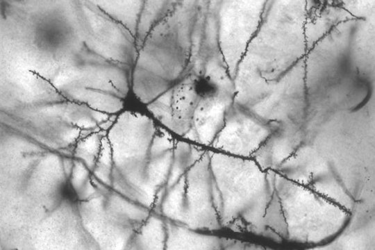 Neurons A microscopic image of neurons.