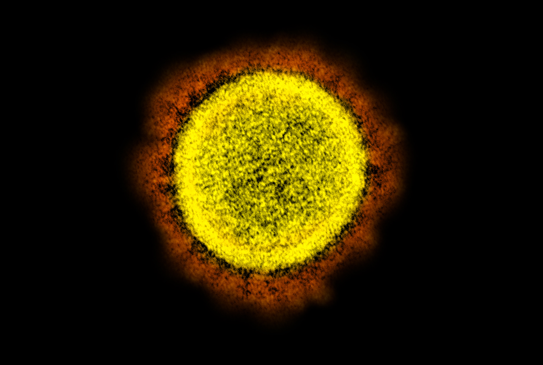 A colored image of SARS-CoV-2, the new coronavirus. The virus's circular envelope is colored yellow, its spike proteins on the outside colored red, all on a black background.