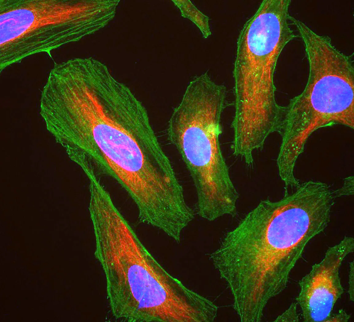 Your body's cells adapt to stress to avoid making mistakes