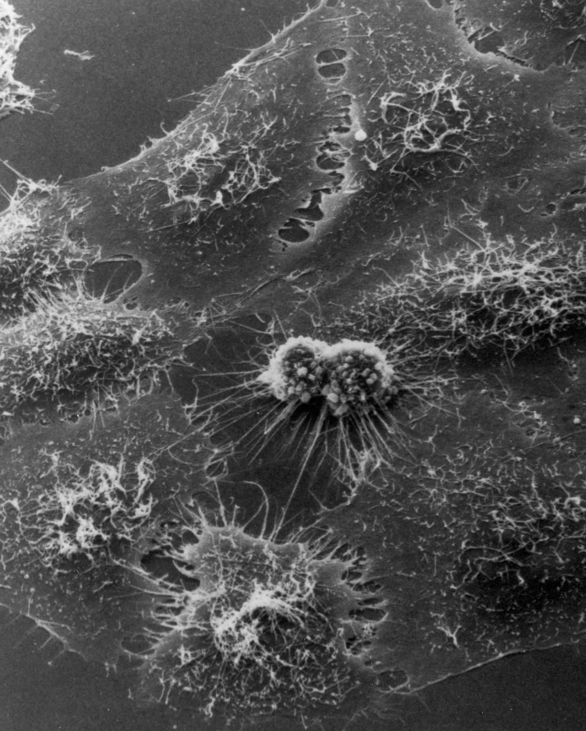 grey microscope image of HeLa cells