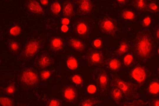 Microglia cells colored red under a microscope