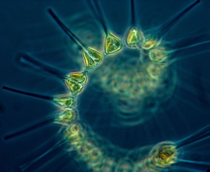 image of plankton through a microscope