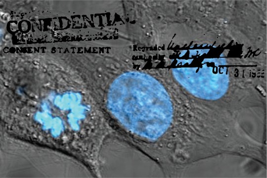 HeLa cells with "confidential consent statement" printed on top