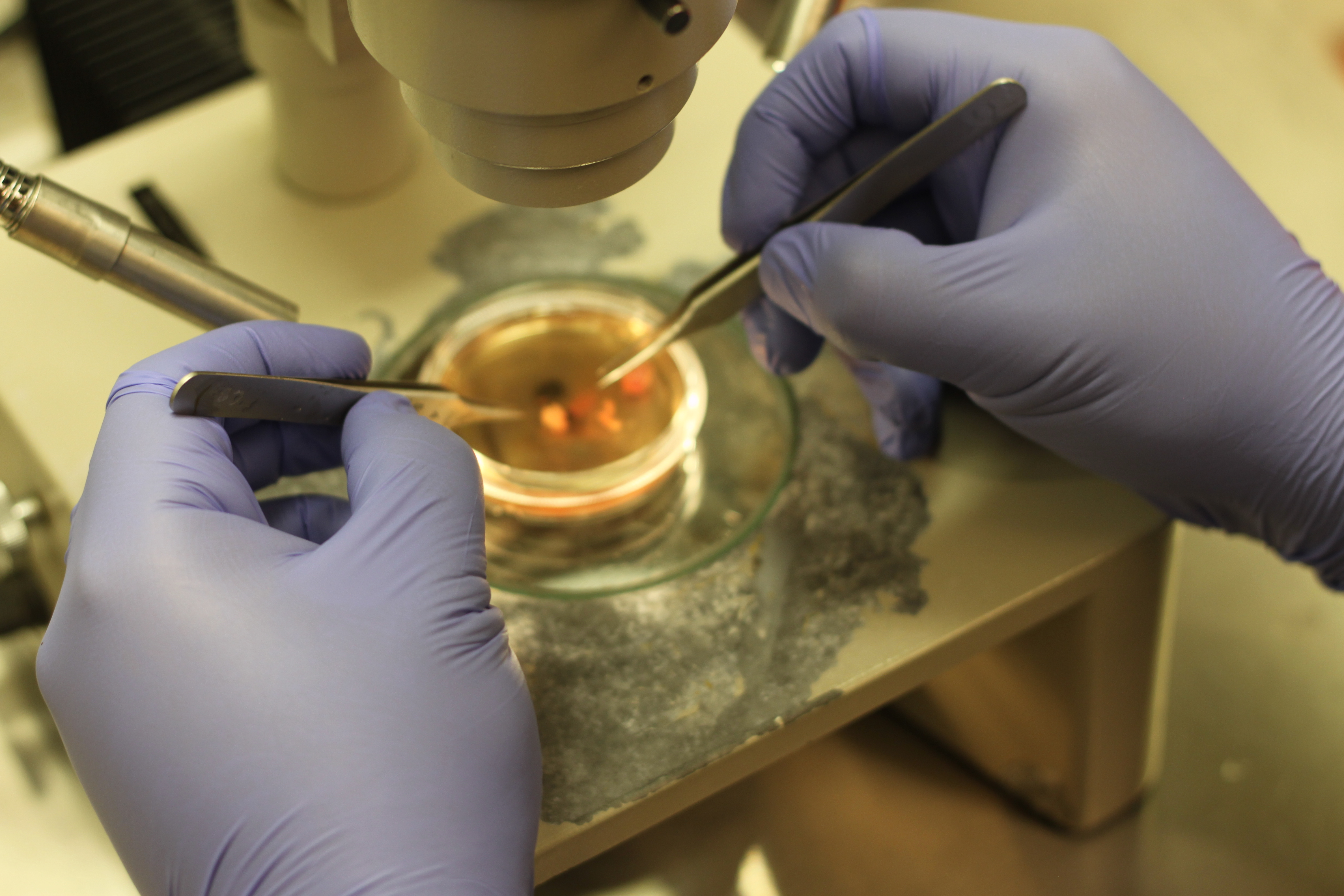 Mini Brains Are Stressed Out And Not As Reliable For Disease