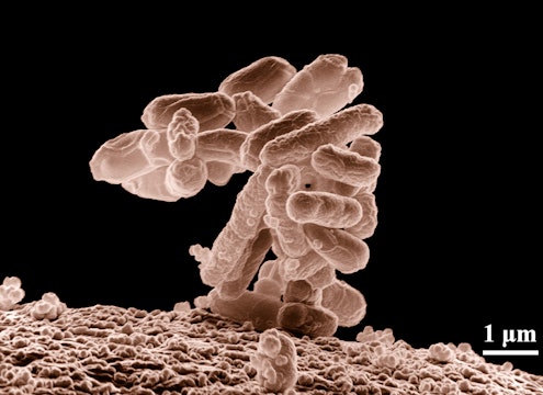 Electron micrograph of Escherichia coli, from the US Department of Agriculture (USDA) Agricultural Research Service (ARS).